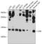 SCA2 antibody, A09496, Boster Biological Technology, Western Blot image 