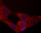 Mitochondrial Transcription Termination Factor 3 antibody, NBP2-75576, Novus Biologicals, Immunocytochemistry image 