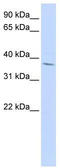 Homeobox protein Nkx-2.3 antibody, TA330193, Origene, Western Blot image 