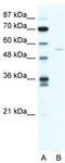 ADP Ribosylation Factor GTPase Activating Protein 2 antibody, TA337266, Origene, Western Blot image 