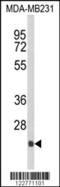 Derlin 2 antibody, 63-603, ProSci, Western Blot image 