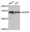 Cell Division Cycle 25A antibody, TA332746, Origene, Western Blot image 