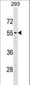5'-Nucleotidase Domain Containing 2 antibody, LS-C158427, Lifespan Biosciences, Western Blot image 