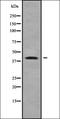 Zinc Finger DHHC-Type Containing 18 antibody, orb338528, Biorbyt, Western Blot image 