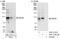DEAD-Box Helicase 54 antibody, A301-313A, Bethyl Labs, Immunoprecipitation image 