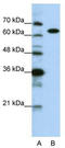 Lysyl-TRNA Synthetase antibody, TA345923, Origene, Western Blot image 