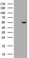 Amylase Alpha 2B (Pancreatic) antibody, TA505107BM, Origene, Western Blot image 