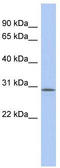 V-Set And Transmembrane Domain Containing 2A antibody, TA333398, Origene, Western Blot image 