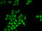 SET Domain And Mariner Transposase Fusion Gene antibody, abx005169, Abbexa, Western Blot image 