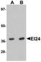 Etoposide-induced protein 2.4 antibody, orb75662, Biorbyt, Western Blot image 