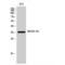 Melanoma-associated antigen 5 antibody, LS-C384402, Lifespan Biosciences, Western Blot image 