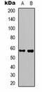 Potassium Voltage-Gated Channel Subfamily A Member 10 antibody, orb334758, Biorbyt, Western Blot image 
