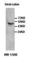 Zinc Finger CCCH-Type Containing 10 antibody, orb77671, Biorbyt, Western Blot image 
