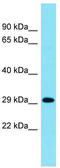 Inhibitory Synaptic Factor 1 antibody, TA334887, Origene, Western Blot image 