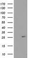 Cyclin Dependent Kinase Inhibitor 3 antibody, CF503593, Origene, Western Blot image 