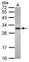 Alcohol Dehydrogenase Iron Containing 1 antibody, GTX119264, GeneTex, Western Blot image 