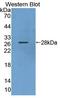 Karyopherin Subunit Alpha 3 antibody, LS-C374552, Lifespan Biosciences, Western Blot image 