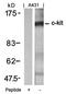 Fibroblast Growth Factor Receptor Like 1 antibody, orb14619, Biorbyt, Western Blot image 