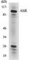 Aryl Hydrocarbon Receptor antibody, EKC1019, Boster Biological Technology, Western Blot image 