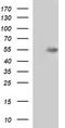 Matrix Metallopeptidase 13 antibody, TA506719S, Origene, Western Blot image 