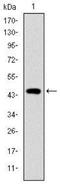 Troponin I2, Fast Skeletal Type antibody, NBP2-37549, Novus Biologicals, Western Blot image 