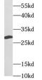 Mitochondrial uncoupling protein 2 antibody, FNab09228, FineTest, Western Blot image 