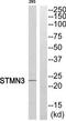 Stathmin 3 antibody, TA315433, Origene, Western Blot image 