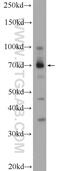 Zinc finger and BTB domain-containing protein 44 antibody, 25421-1-AP, Proteintech Group, Western Blot image 