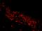 NBS antibody, IHC-00258, Bethyl Labs, Immunofluorescence image 