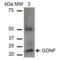 Glial Cell Derived Neurotrophic Factor antibody, SPC-710D-P594, StressMarq, Western Blot image 