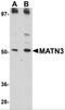 Matrilin 3 antibody, 5127, ProSci, Western Blot image 