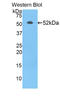 Sialic Acid Acetylesterase antibody, LS-C296402, Lifespan Biosciences, Western Blot image 