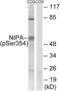 Zinc Finger C3HC-Type Containing 1 antibody, LS-C199324, Lifespan Biosciences, Western Blot image 
