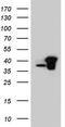 RNA Transcription, Translation And Transport Factor antibody, CF804058, Origene, Western Blot image 