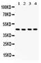 Cystathionine Gamma-Lyase antibody, PA5-79089, Invitrogen Antibodies, Western Blot image 