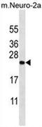 Zinc Finger CCHC-Type And RNA Binding Motif Containing 1 antibody, AP54628PU-N, Origene, Western Blot image 