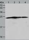 BCL2 Antagonist/Killer 1 antibody, TA321299, Origene, Western Blot image 