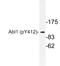 ABL Proto-Oncogene 1, Non-Receptor Tyrosine Kinase antibody, LS-C178071, Lifespan Biosciences, Western Blot image 