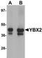 Y-Box Binding Protein 2 antibody, orb75477, Biorbyt, Western Blot image 