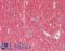 Synuclein Alpha antibody, LS-B11186, Lifespan Biosciences, Immunohistochemistry paraffin image 