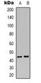 Mitogen-Activated Protein Kinase Kinase 4 antibody, abx133635, Abbexa, Western Blot image 