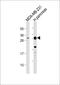 Serine Protease 3 antibody, 56-124, ProSci, Western Blot image 