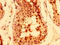 Tankyrase-1 antibody, LS-C673605, Lifespan Biosciences, Immunohistochemistry paraffin image 