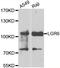 Leucine Rich Repeat Containing G Protein-Coupled Receptor 6 antibody, abx006470, Abbexa, Western Blot image 