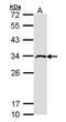 Inositol Monophosphatase 2 antibody, GTX103636, GeneTex, Western Blot image 