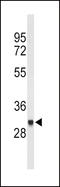 Fc Fragment Of IgG Receptor Ib antibody, LS-C166100, Lifespan Biosciences, Western Blot image 