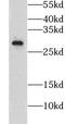 Claudin 22 antibody, FNab01736, FineTest, Western Blot image 