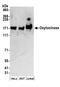 Leucyl And Cystinyl Aminopeptidase antibody, A304-363A, Bethyl Labs, Western Blot image 