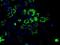 Aconitase antibody, GTX84966, GeneTex, Immunofluorescence image 