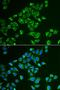 Conserved oligomeric Golgi complex subunit 2 antibody, orb247328, Biorbyt, Immunocytochemistry image 
